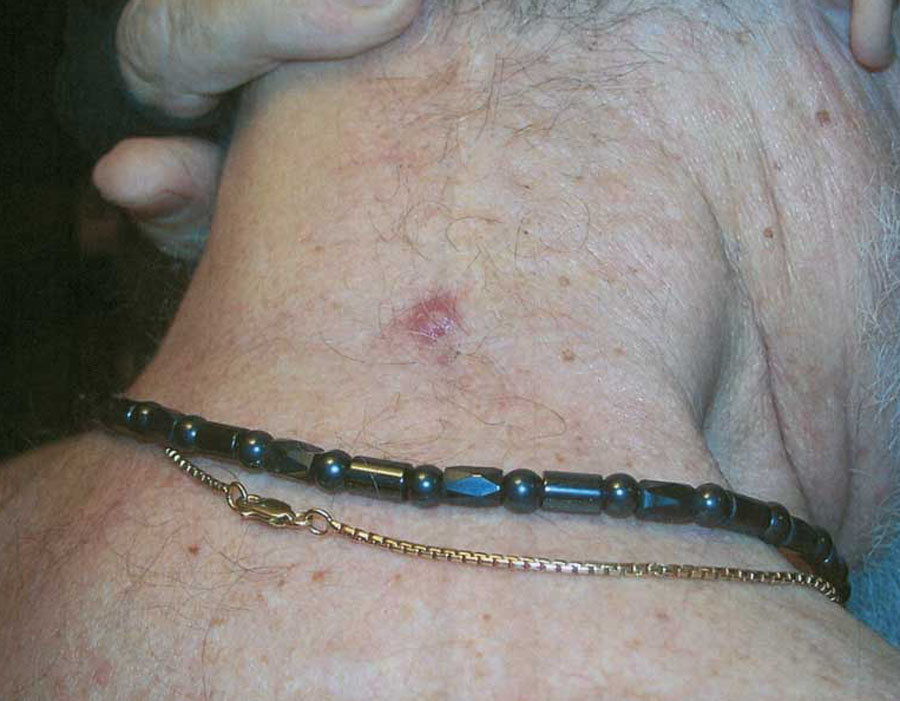 pic 4