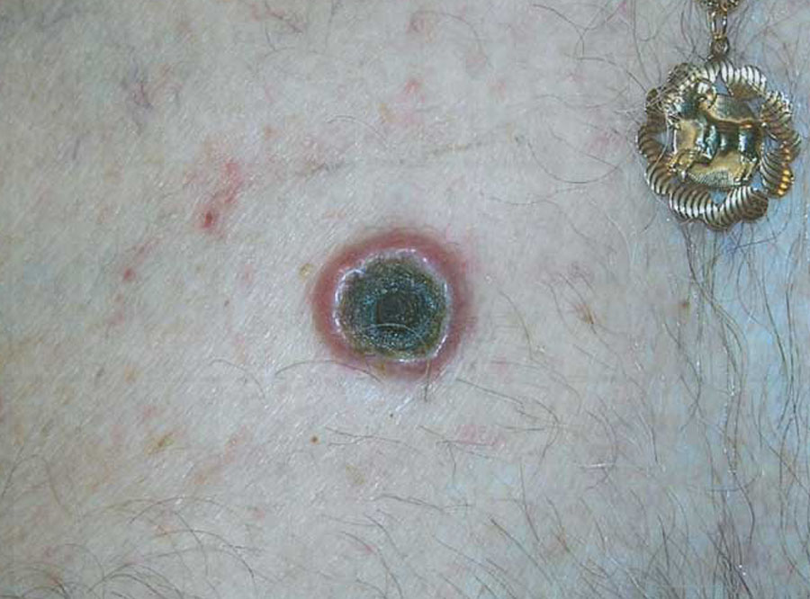 pic 6